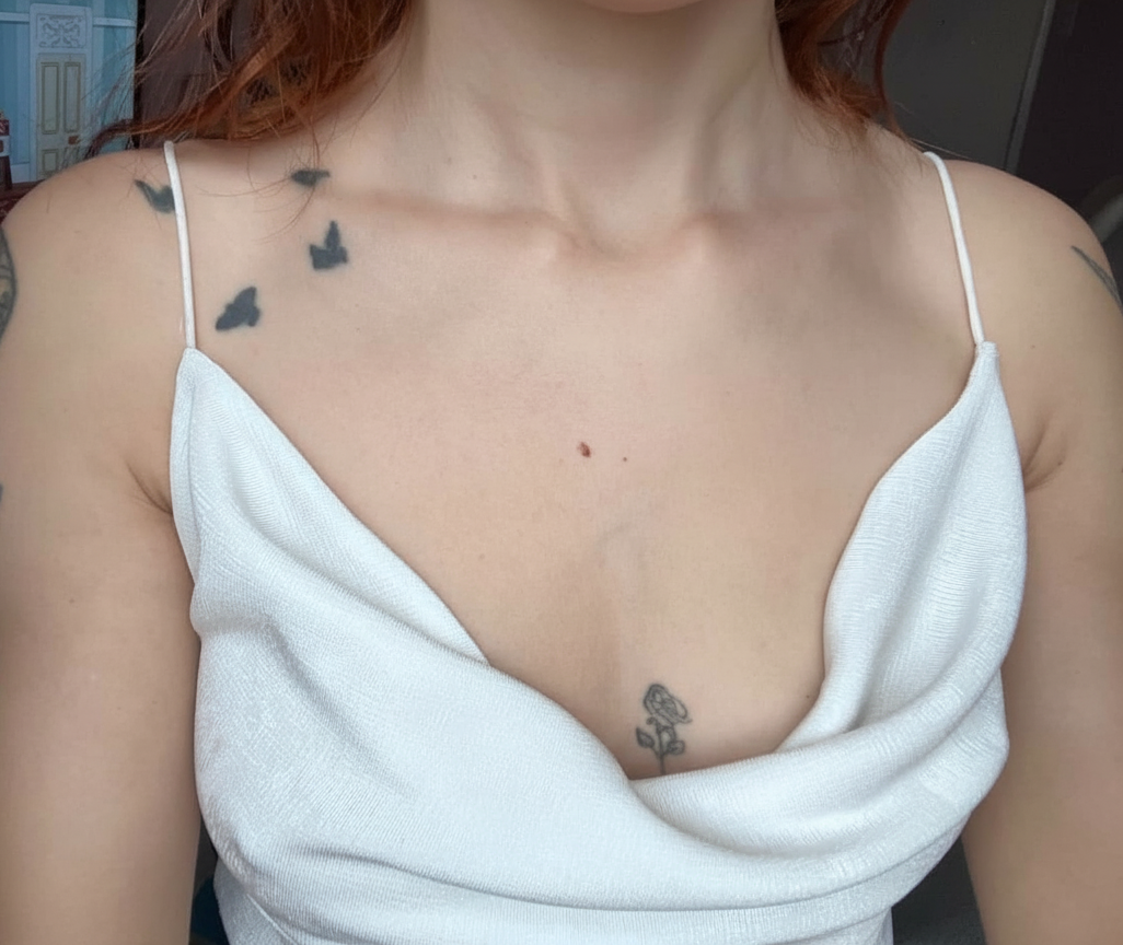 image comparison before